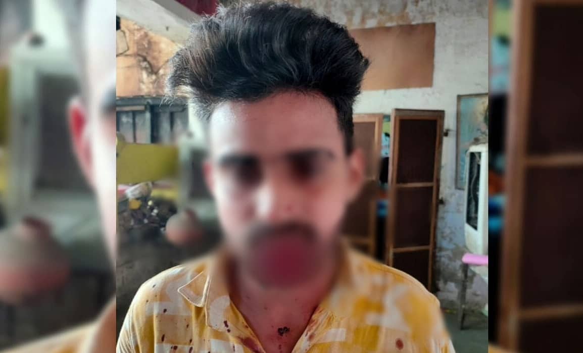 ಯುವಕನ ತುಟಿ ಕಚ್ಚಿ ಕತ್ತರಿಸಿ ಅತ್ಯಾಚಾರದಿಂದ ತಪ್ಪಿಸಿಕೊಂಡ ದಿಟ್ಟ ಮಹಿಳೆ!