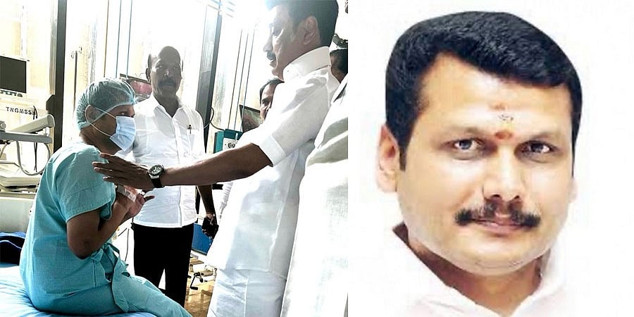 ತಮಿಳುನಾಡು ಸಚಿವ ಸೆಂಥಿಲ್ ಬಾಲಾಜಿಗೆ ಬೈಪಾಸ್ ಸರ್ಜರಿ