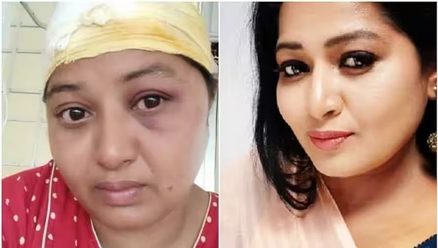 ಜಮೀನು ವಿವಾದ: ಸ್ಯಾಂಡಲ್ವುಡ್ ನಟಿ ಅನುಗೌಡ ಮೇಲೆ ಹಲ್ಲೆ; ಆಸ್ಪತ್ರೆಗೆ ದಾಖಲು