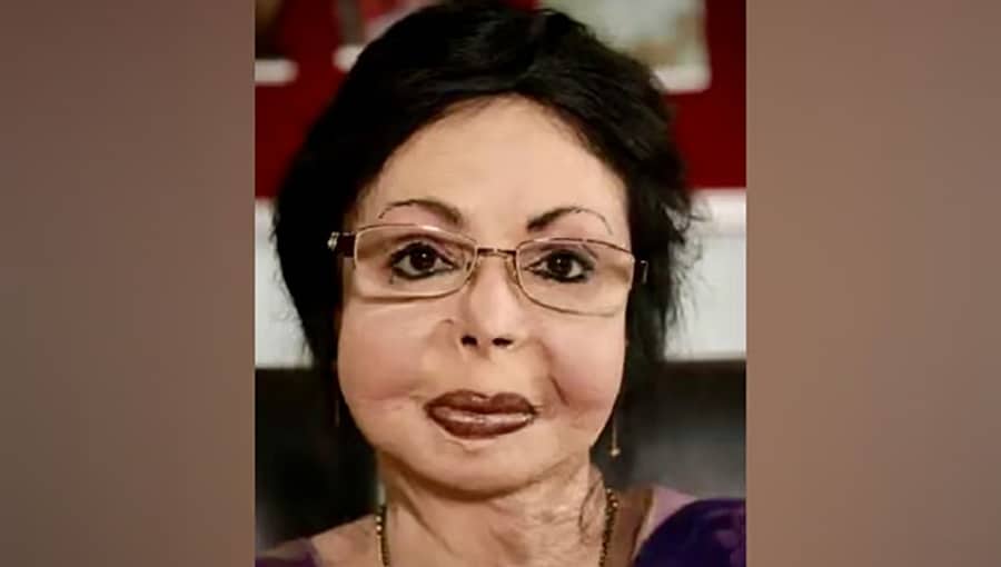 ಸುಟ್ಟಗಾಯದಿಂದ ಪದ್ಮಶ್ರೀವರೆಗೆ: 'ಬೆಂಕಿಯಲ್ಲಿ ಅರಳಿದ ಹೂವು' ಪ್ರೇಮಾ ಧನರಾಜ್!