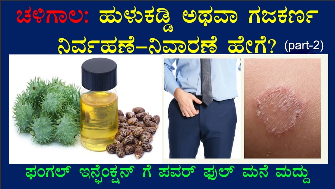 ಚಳಿಗಾಲ: ಹುಳುಕಡ್ಡಿ ಅಥವಾ ಗಜಕರ್ಣ ನಿರ್ವಹಣೆ-ನಿವಾರಣೆ ಹೇಗೆ? part-2